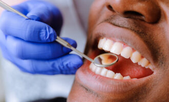 How Much Does a Tooth Extraction Cost on Average?