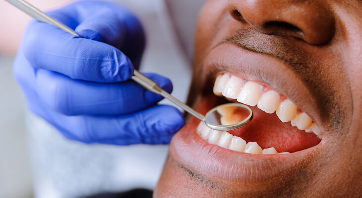 How much does a tooth extraction cost? Man gets teeth examined at dentist